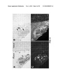 FUNGUS-INDUCED INFLAMMATION AND EOSINOPHIL DEGRANULATION diagram and image