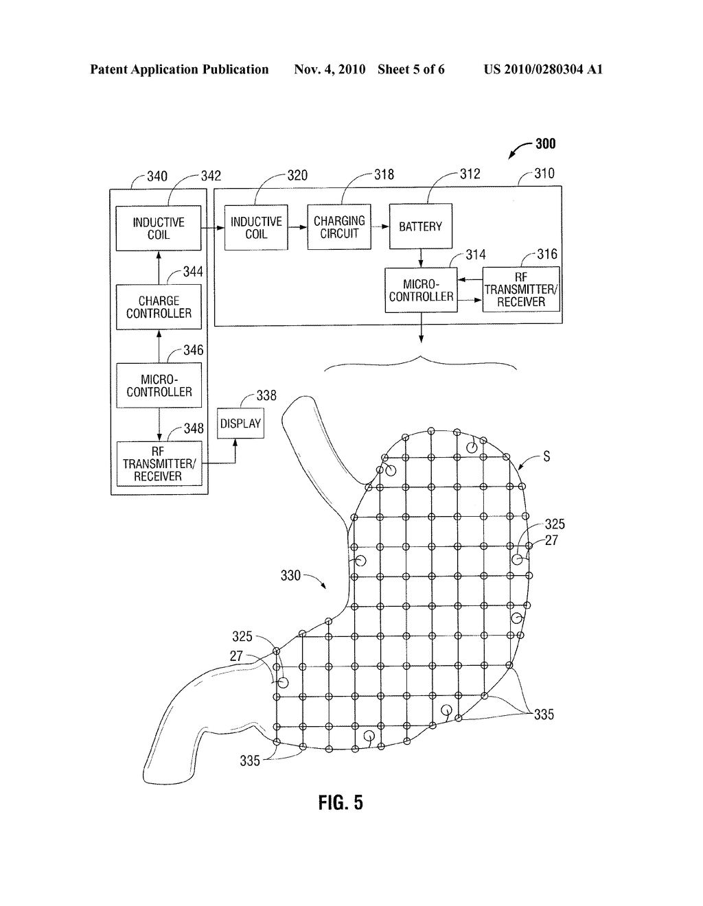 Magnetic Gastric Reduction Device - diagram, schematic, and image 06