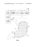 Magnetic Gastric Reduction Device diagram and image