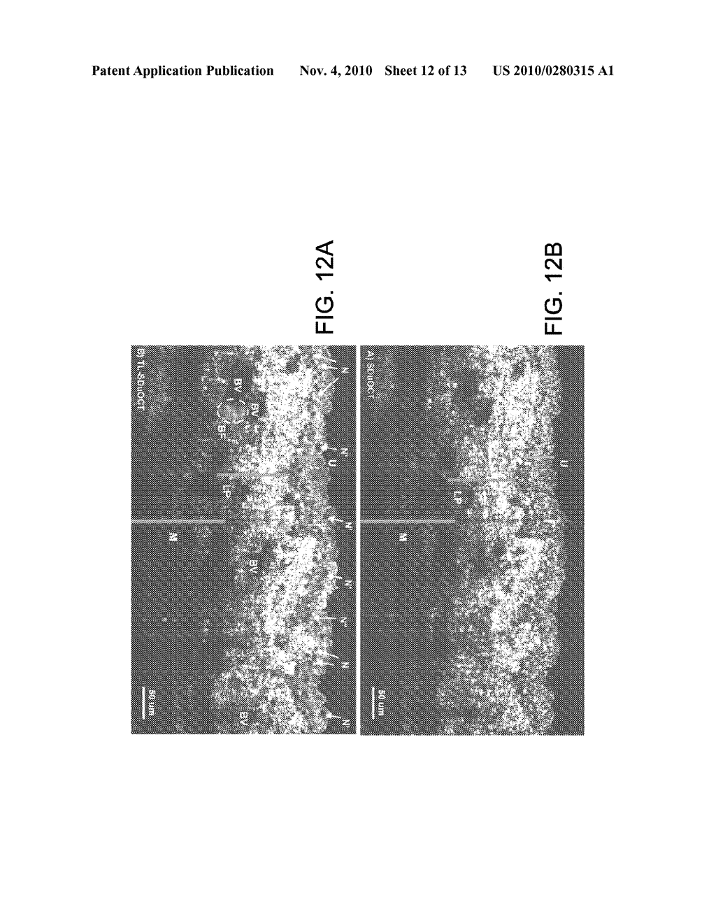 OPTICAL COHERENCE TOMOGRAPHY SYSTEMS AND METHODS - diagram, schematic, and image 13