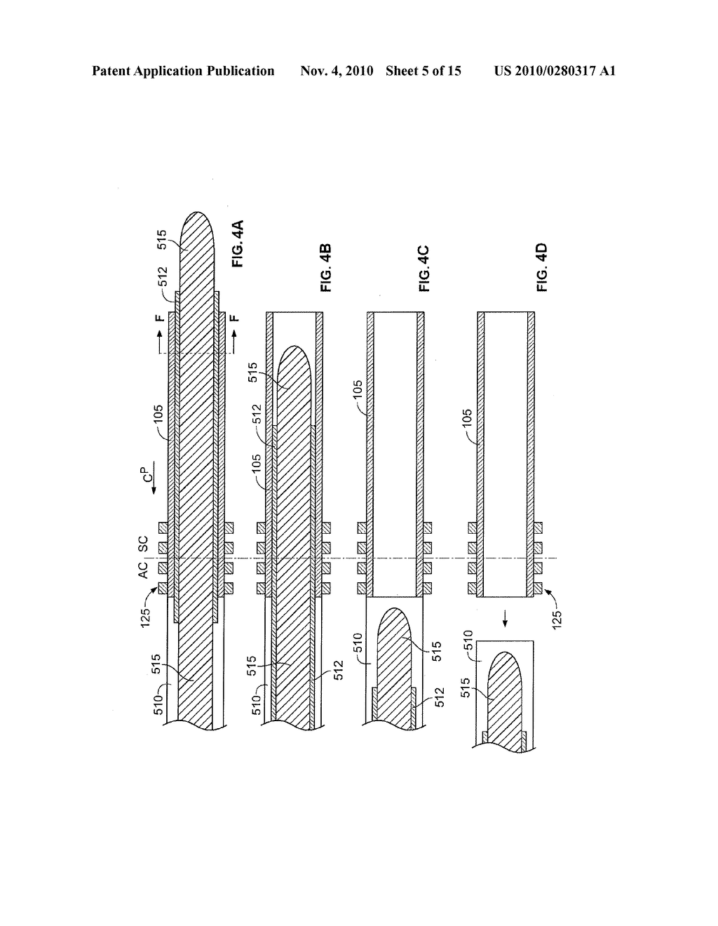 OCULAR IMPLANT DELIVERY SYSTEMS AND METHODS - diagram, schematic, and image 06