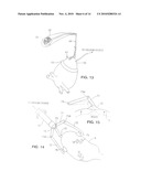 Organ Manipulator Having Suction Member Supported with Freedom to Move Relative to Its Support diagram and image