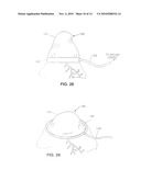 Organ Manipulator Having Suction Member Supported with Freedom to Move Relative to Its Support diagram and image