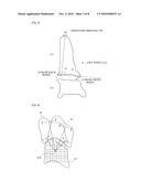 APPARATUS AND METHOD FOR ASSESSING ROTATIONAL BONE KINEMATICS diagram and image