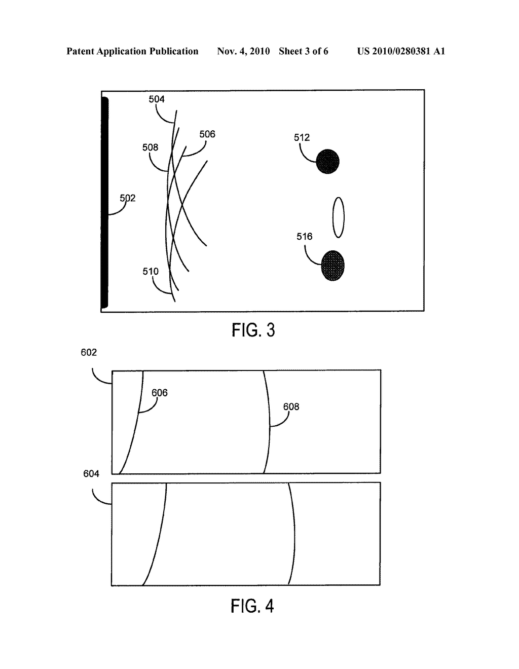 SYSTEM AND METHOD FOR ACCELERATED FOCUSED ULTRASOUND IMAGING - diagram, schematic, and image 04