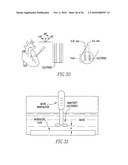 Method and apparatus for monitoring an organ of a patient diagram and image