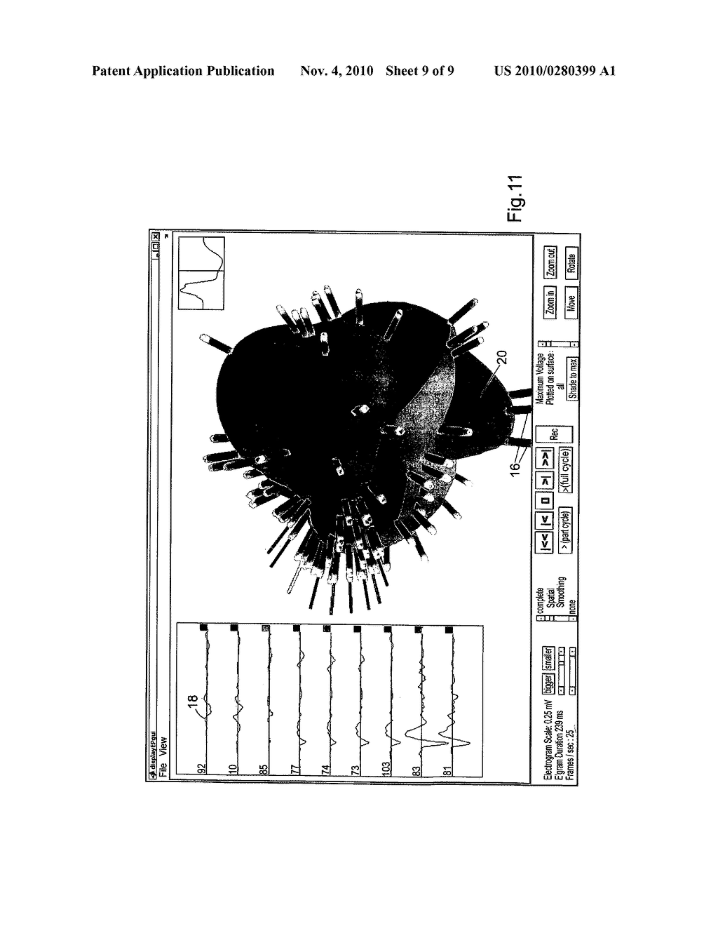 METHOD OF AND APPARATUS FOR GENERATING A MODEL OF A CARDIAC SURFACE HAVING A PLURALITY OF IMAGES REPRESENTING ELECTROGRAM VOLTAGES - diagram, schematic, and image 10