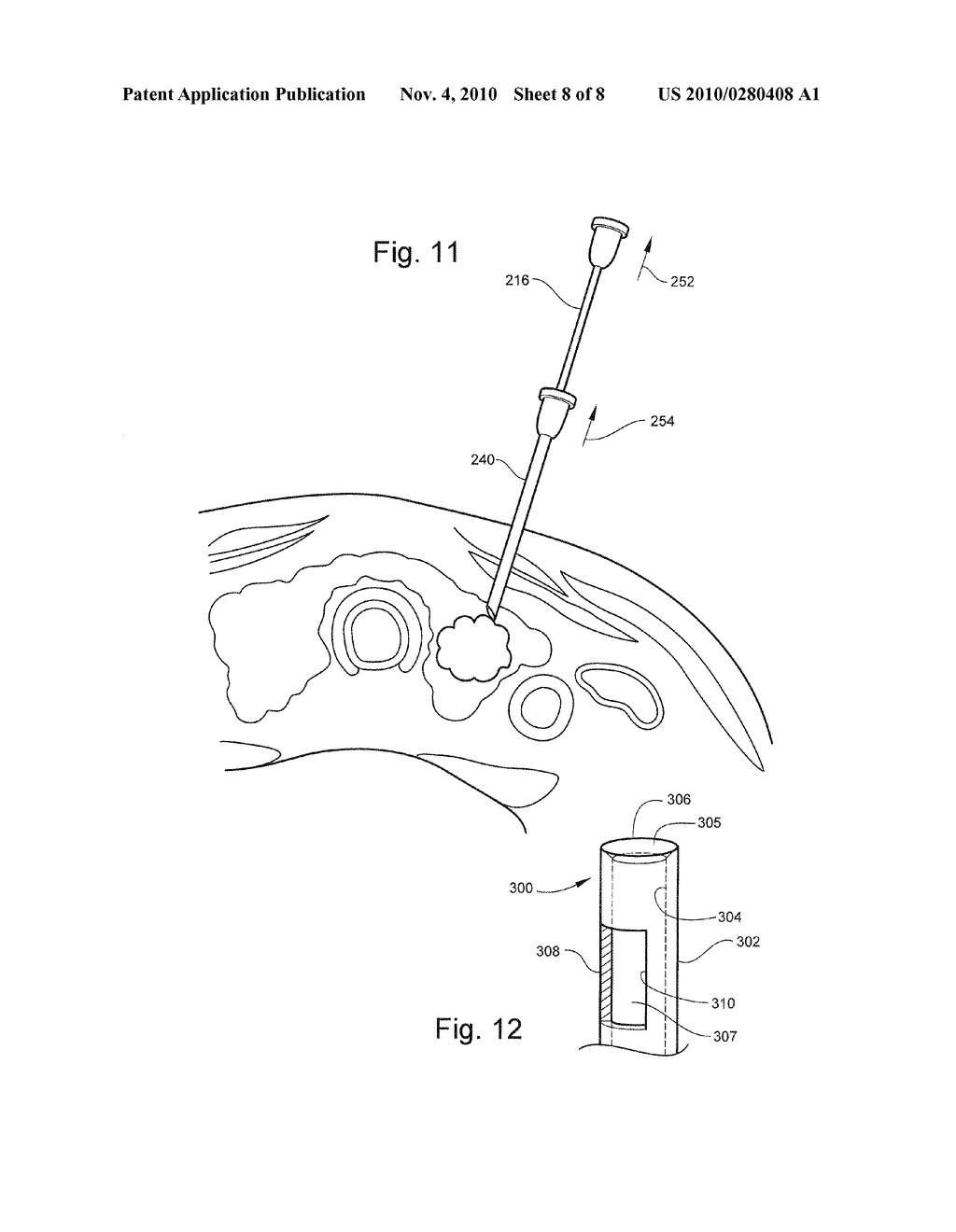 FINE NEEDLE BIOPSY SYSTEM AND METHOD OF USE - diagram, schematic, and image 09