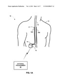 THERAPY SYSTEM INCLUDING MULTIPLE POSTURE SENSORS diagram and image