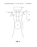 SYSTEM AND METHOD FOR VARIABLE DEPTH ULTRASOUND TREATMENT diagram and image