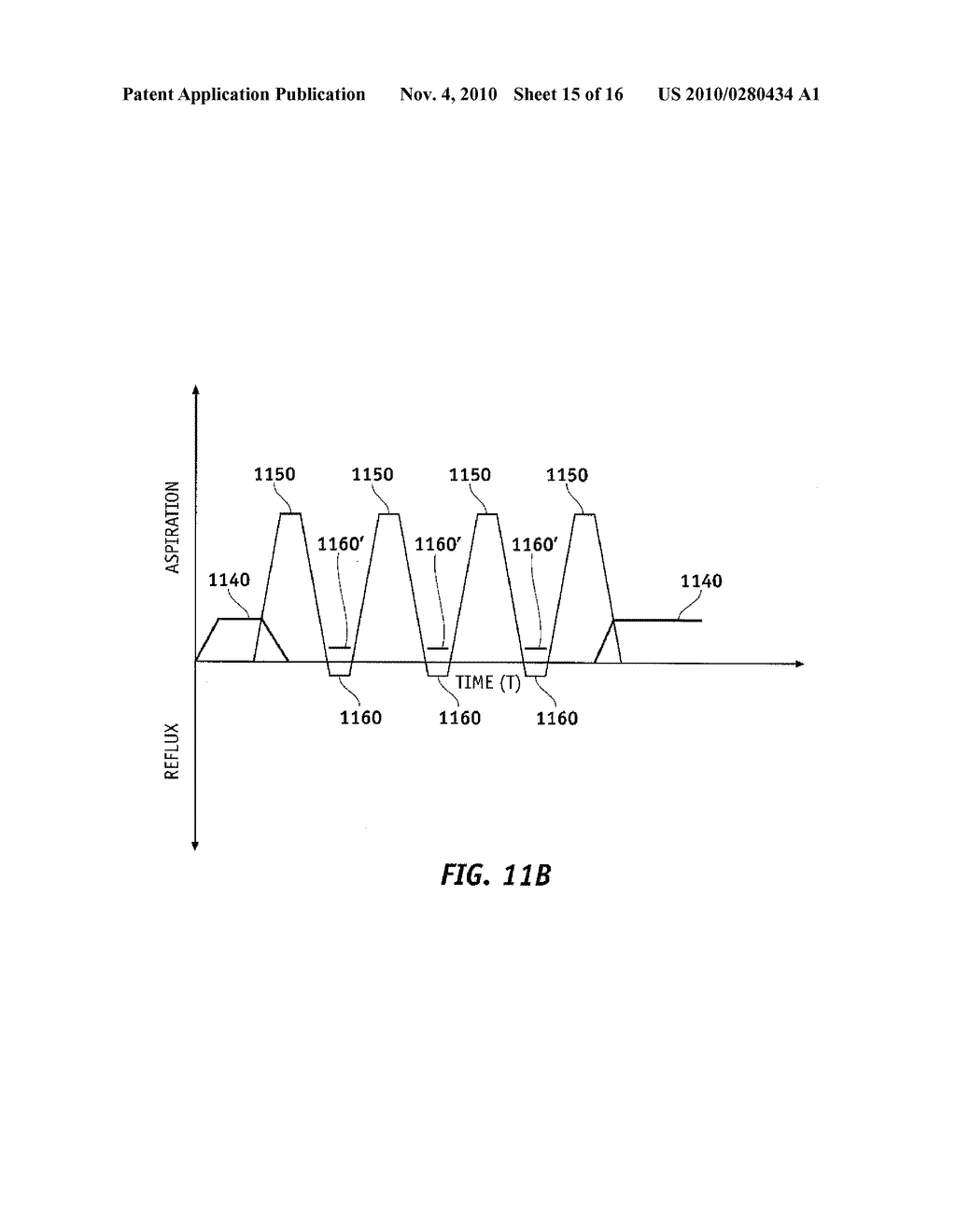 AUTOMATICALLY PULSING DIFFERENT ASPIRATION LEVELS TO AN OCULAR PROBE - diagram, schematic, and image 16