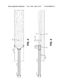 Apparatus and Method for Reducing Contamination of Surgical Sites diagram and image