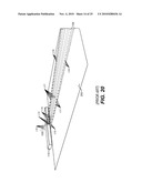 Apparatus and Method for Reducing Contamination of Surgical Sites diagram and image