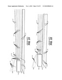 Apparatus and Method for Reducing Contamination of Surgical Sites diagram and image