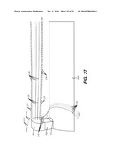 Apparatus and Method for Reducing Contamination of Surgical Sites diagram and image