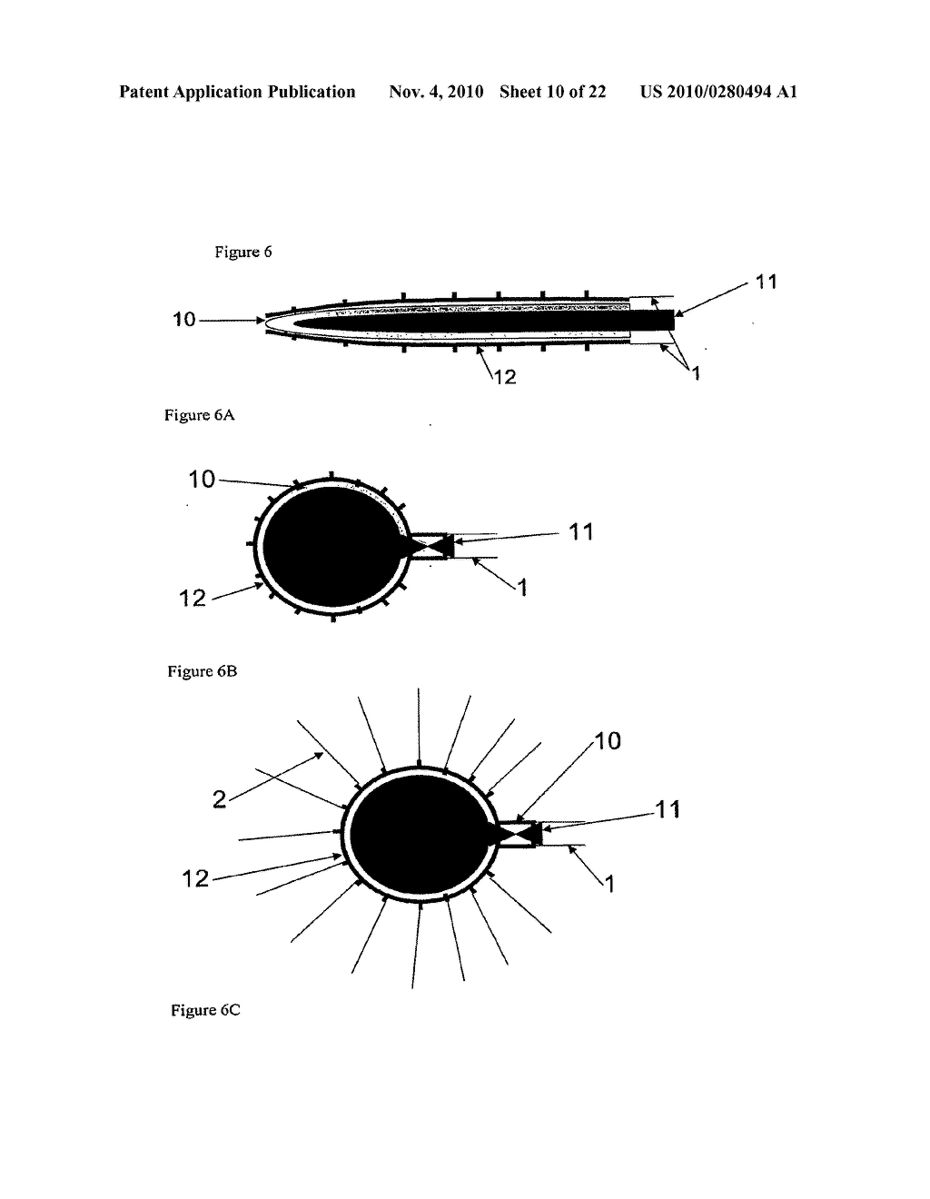 CATHETER AND ARRAY FOR ANTICANCER THERAPY - diagram, schematic, and image 11