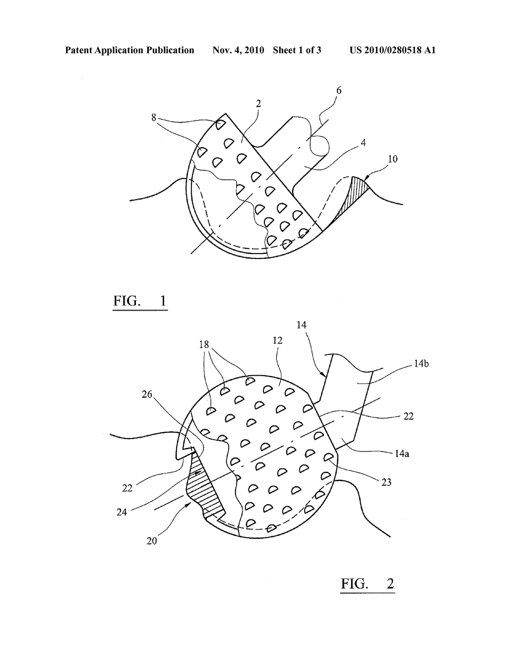 INSTRUMENT FOR REMOVING TISSUE - diagram, schematic, and image 02