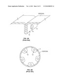 ENDOSCOPIC IMPLANT SYSTEM AND METHOD diagram and image