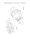 ENDOSCOPIC IMPLANT SYSTEM AND METHOD diagram and image