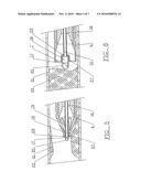 ATHERECTOMY SYSTEM WITH IMAGING GUIDEWIRE diagram and image