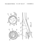 ATHERECTOMY SYSTEM WITH IMAGING GUIDEWIRE diagram and image