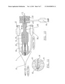 ATHERECTOMY SYSTEM WITH IMAGING GUIDEWIRE diagram and image