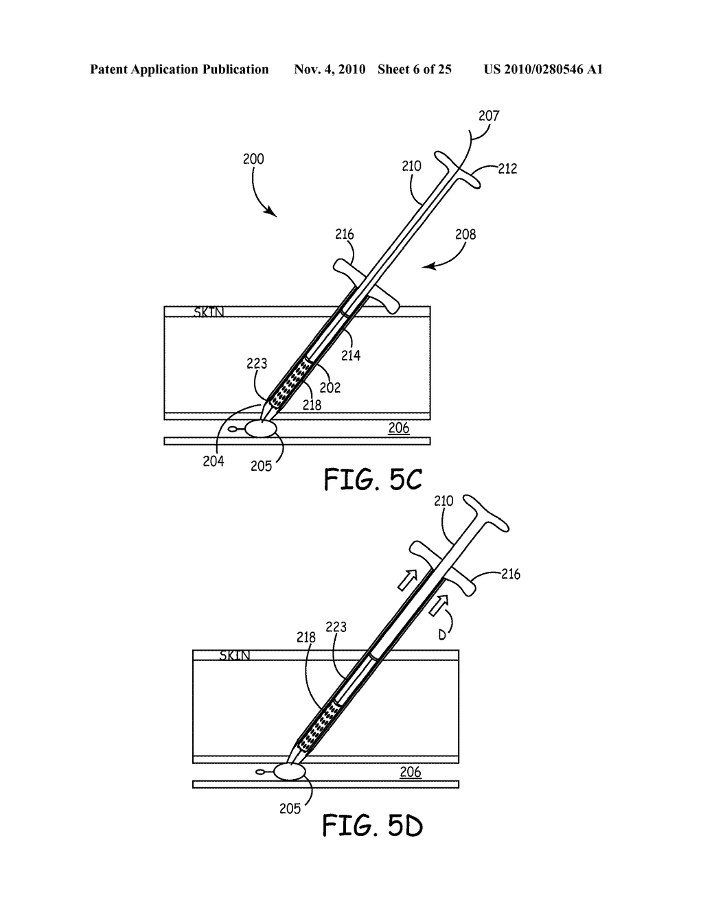 BIOMATERIALS FOR TRACK AND PUNCTURE CLOSURE - diagram, schematic, and image 07