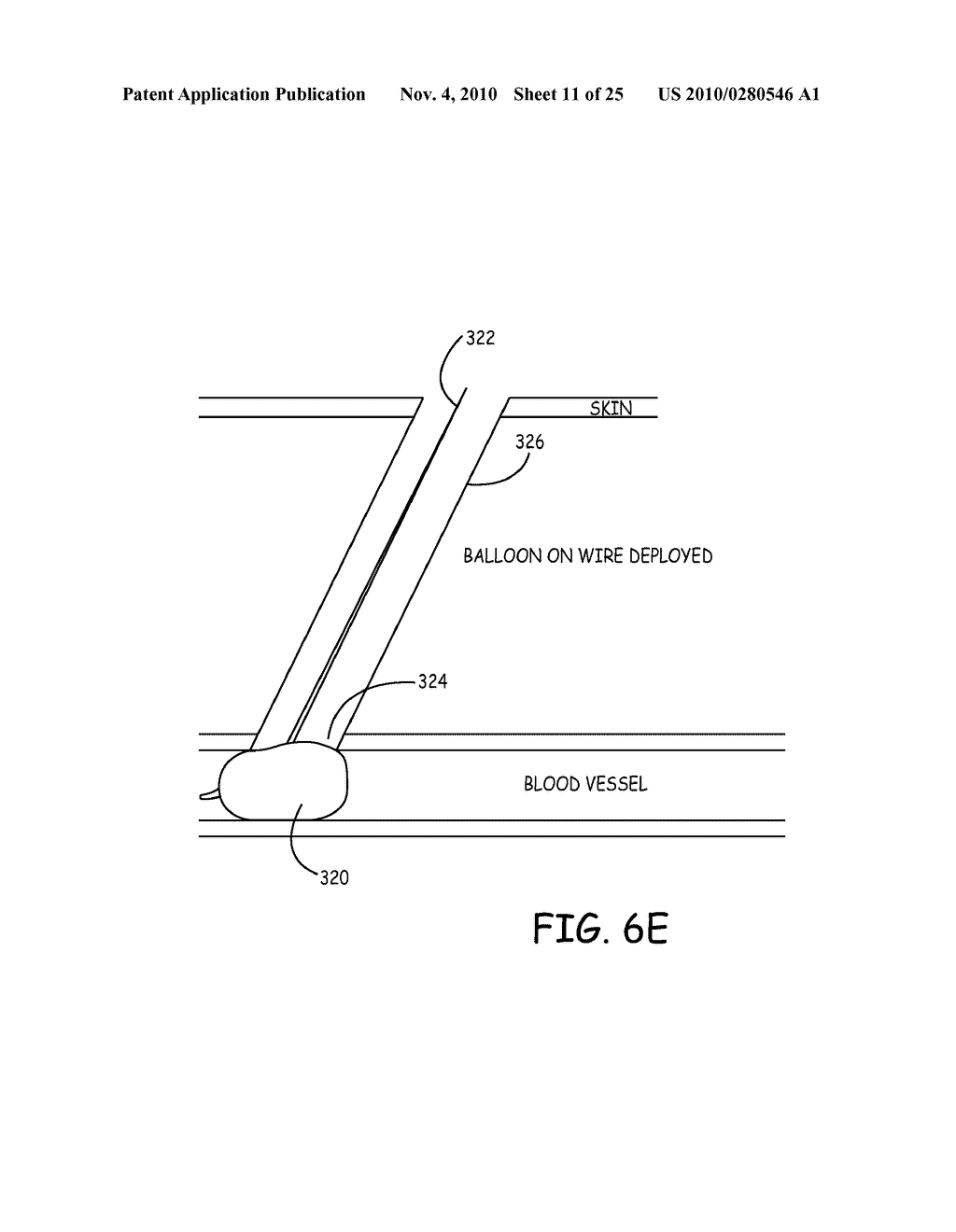 BIOMATERIALS FOR TRACK AND PUNCTURE CLOSURE - diagram, schematic, and image 12