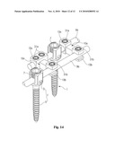 SIDE CLICK CONNECTOR APPARATUS FOR CONNECTION OF SPINAL RODS diagram and image