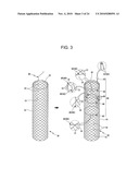 DRAWSTRING FOR REMOVAL OF STENT diagram and image