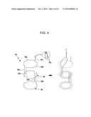 DRAWSTRING FOR REMOVAL OF STENT diagram and image