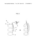 DRAWSTRING FOR REMOVAL OF STENT diagram and image