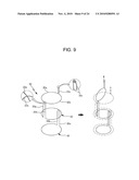 DRAWSTRING FOR REMOVAL OF STENT diagram and image