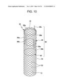 DRAWSTRING FOR REMOVAL OF STENT diagram and image