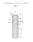 DRAWSTRING FOR REMOVAL OF STENT diagram and image