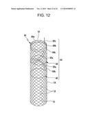 DRAWSTRING FOR REMOVAL OF STENT diagram and image