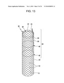 DRAWSTRING FOR REMOVAL OF STENT diagram and image