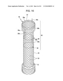 DRAWSTRING FOR REMOVAL OF STENT diagram and image