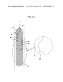 DRAWSTRING FOR REMOVAL OF STENT diagram and image