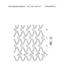 STENT WITH VARIABLE FEATURES TO OPTIMIZE SUPPORT AND METHOD OF MAKING SUCH STENT diagram and image