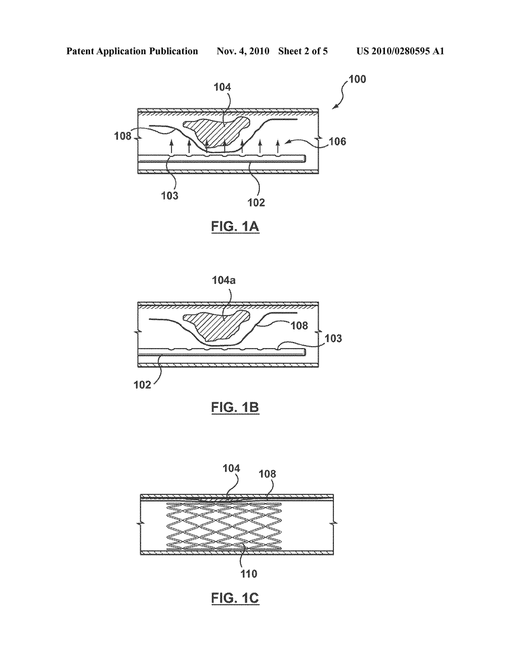 Method and Device for Localized Administration of Calcium Chelating Agent - diagram, schematic, and image 03