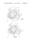 Mitral Valve Device Using Conditioned Shape Memory Alloy diagram and image