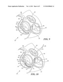 Mitral Valve Device Using Conditioned Shape Memory Alloy diagram and image