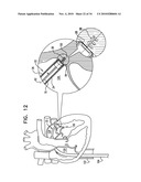 OVER-WIRE ROTATION TOOL diagram and image