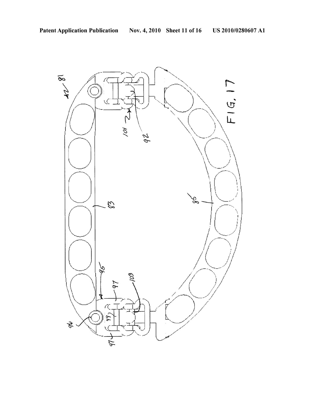 ADJUSTABLE ANNULOPLASTY RINGS - diagram, schematic, and image 12