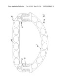 ADJUSTABLE ANNULOPLASTY RINGS diagram and image