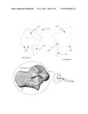 System and method for modifying talocalcaneal relationship in a foot diagram and image