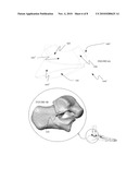 System and method for modifying talocalcaneal relationship in a foot diagram and image