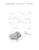 System and method for modifying talocalcaneal relationship in a foot diagram and image