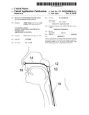 DEVICES AND METHODS FOR TREATING SLEEP DISORDERED BREATHING diagram and image